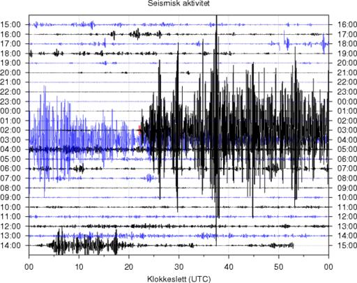 seismometer